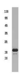 Human OTUD4 protein, His tag. GTX106632-pro