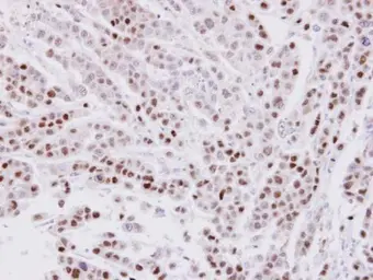 Anti-CIP29 antibody [N1C3] used in IHC (Paraffin sections) (IHC-P). GTX106633