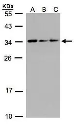Anti-CIP29 antibody [N1C3] used in Western Blot (WB). GTX106633