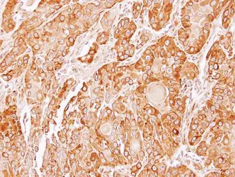 Anti-TXNDC4 antibody [C1C3] used in IHC (Paraffin sections) (IHC-P). GTX106636