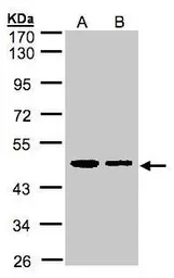 Anti-TXNDC4 antibody [C1C3] used in Western Blot (WB). GTX106636