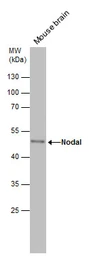 Anti-Nodal antibody used in Western Blot (WB). GTX106644