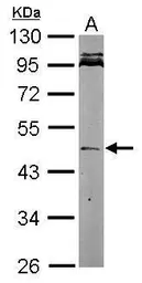 Anti-Nodal antibody used in Western Blot (WB). GTX106644