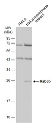 Anti-Rab5b antibody used in Western Blot (WB). GTX106661