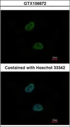 Anti-C20orf11 antibody [N1C3] used in Immunocytochemistry/ Immunofluorescence (ICC/IF). GTX106672