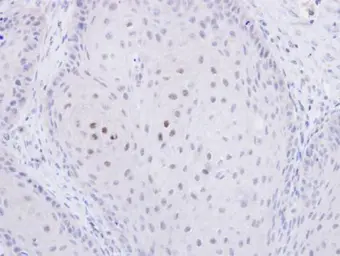 Anti-C20orf11 antibody [N1C3] used in IHC (Paraffin sections) (IHC-P). GTX106672