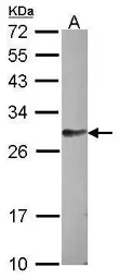 Anti-FAM122B antibody [N1C2] used in Western Blot (WB). GTX106678
