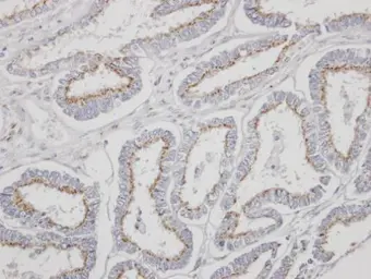 Anti-YIPF4 antibody [N1C2] used in IHC (Paraffin sections) (IHC-P). GTX106680