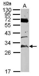 Anti-TATDN3 antibody used in Western Blot (WB). GTX106682
