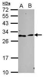 Anti-TATDN3 antibody used in Western Blot (WB). GTX106682