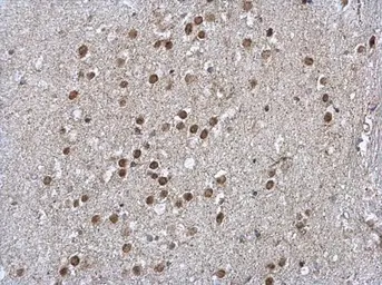 Anti-LIMD1 antibody [C2C3], C-term used in IHC (Paraffin sections) (IHC-P). GTX106685