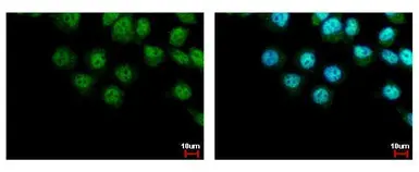 Anti-LIMD1 antibody [C2C3], C-term used in Immunocytochemistry/ Immunofluorescence (ICC/IF). GTX106685