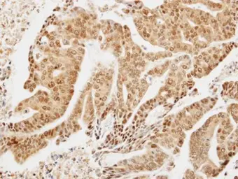 Anti-LIMD1 antibody [C2C3], C-term used in IHC (Paraffin sections) (IHC-P). GTX106685