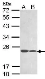 Anti-LOC283129 antibody [N1C3] used in Western Blot (WB). GTX106687
