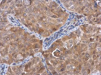 Anti-ACTL8 antibody used in IHC (Paraffin sections) (IHC-P). GTX106696