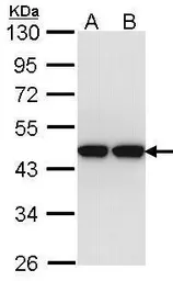 Anti-ACTL8 antibody used in Western Blot (WB). GTX106696