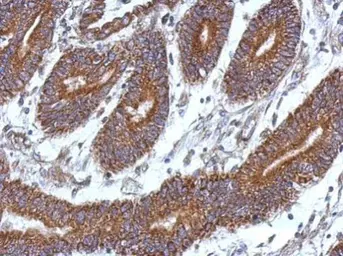 Anti-CCDC37 antibody used in IHC (Paraffin sections) (IHC-P). GTX106700