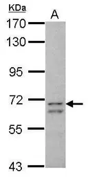 Anti-CCDC37 antibody used in Western Blot (WB). GTX106700