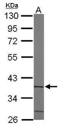 Anti-ACMSD antibody [N2C3] used in Western Blot (WB). GTX106739