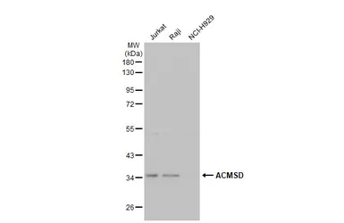 Anti-ACMSD antibody [N2C3] used in Western Blot (WB). GTX106739