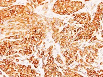 Anti-Diablo antibody [N1C3] used in IHC (Paraffin sections) (IHC-P). GTX106746