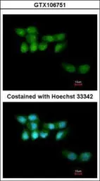 Anti-UVSSA antibody [N1N2], N-term used in Immunocytochemistry/ Immunofluorescence (ICC/IF). GTX106751