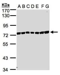 Anti-UVSSA antibody [N1N2], N-term used in Western Blot (WB). GTX106751