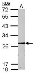 Anti-MMAB antibody used in Western Blot (WB). GTX106767
