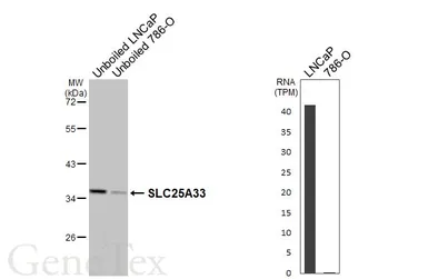 Anti-SLC25A33 antibody [N3C3] used in Western Blot (WB). GTX106785