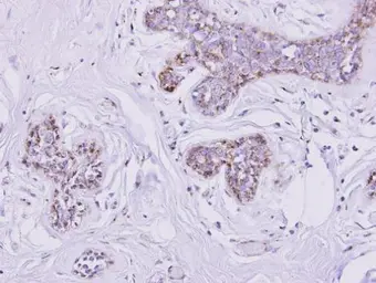 Anti-SLC25A33 antibody [N3C3] used in IHC (Paraffin sections) (IHC-P). GTX106785