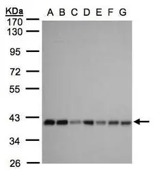 Anti-SLC25A33 antibody [N3C3] used in Western Blot (WB). GTX106785