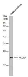 Anti-PACAP antibody [N1C3] used in Western Blot (WB). GTX106794