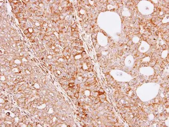 Anti-THUMPD3 antibody [N1N3] used in IHC (Paraffin sections) (IHC-P). GTX106796