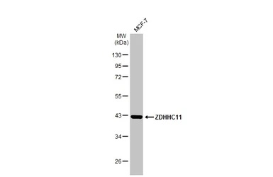 Anti-ZDHHC11 antibody used in Western Blot (WB). GTX106800