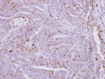 Anti-ZDHHC11 antibody used in IHC (Paraffin sections) (IHC-P). GTX106800