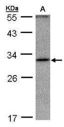 Anti-ANKRD45 antibody used in Western Blot (WB). GTX106810