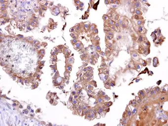 Anti-TATDN1 antibody [N1C2] used in IHC (Paraffin sections) (IHC-P). GTX106818
