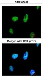 Anti-TATDN1 antibody [N1C2] used in Immunocytochemistry/ Immunofluorescence (ICC/IF). GTX106818