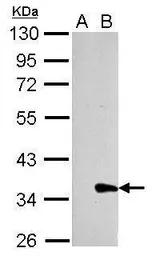 Anti-Galectin 8 antibody used in Western Blot (WB). GTX106821
