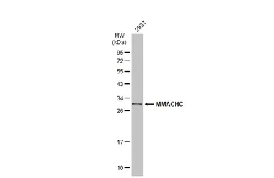 Anti-MMACHC antibody [N1C2] used in Western Blot (WB). GTX106822