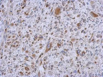 Anti-MMACHC antibody [N1C2] used in IHC (Paraffin sections) (IHC-P). GTX106822