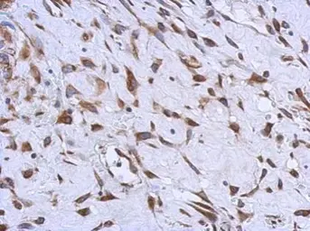 Anti-MMACHC antibody [N1C2] used in IHC (Paraffin sections) (IHC-P). GTX106822