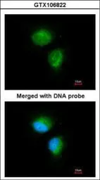 Anti-MMACHC antibody [N1C2] used in Immunocytochemistry/ Immunofluorescence (ICC/IF). GTX106822