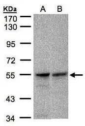 Anti-FOXRED1 antibody [C1C3] used in Western Blot (WB). GTX106823