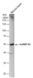 Anti-hnRNP H2 antibody used in Western Blot (WB). GTX106825