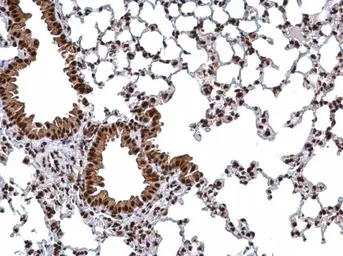 Anti-hnRNP H2 antibody used in IHC (Paraffin sections) (IHC-P). GTX106825
