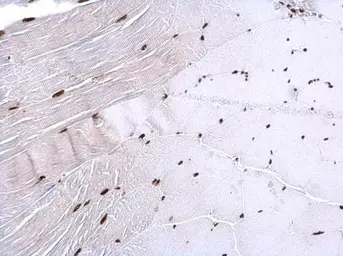 Anti-hnRNP H2 antibody used in IHC (Paraffin sections) (IHC-P). GTX106825