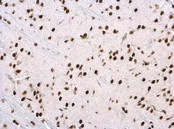 Anti-hnRNP H2 antibody used in IHC (Paraffin sections) (IHC-P). GTX106825