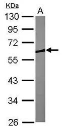 Anti-Coronin 1B antibody [N1N3] used in Western Blot (WB). GTX106831