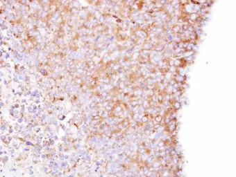 Anti-Coronin 1B antibody [N1N3] used in IHC (Paraffin sections) (IHC-P). GTX106831